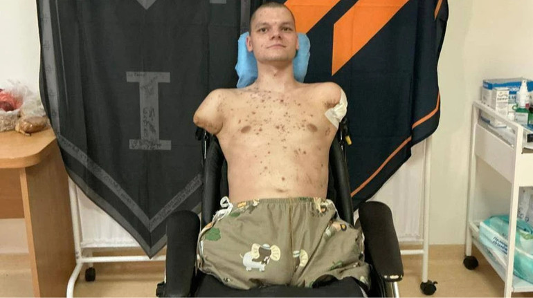 У відділенні ПриватБанку не видали картку ветерану з ампутацією всіх кінцівок: в НБУ відреагували